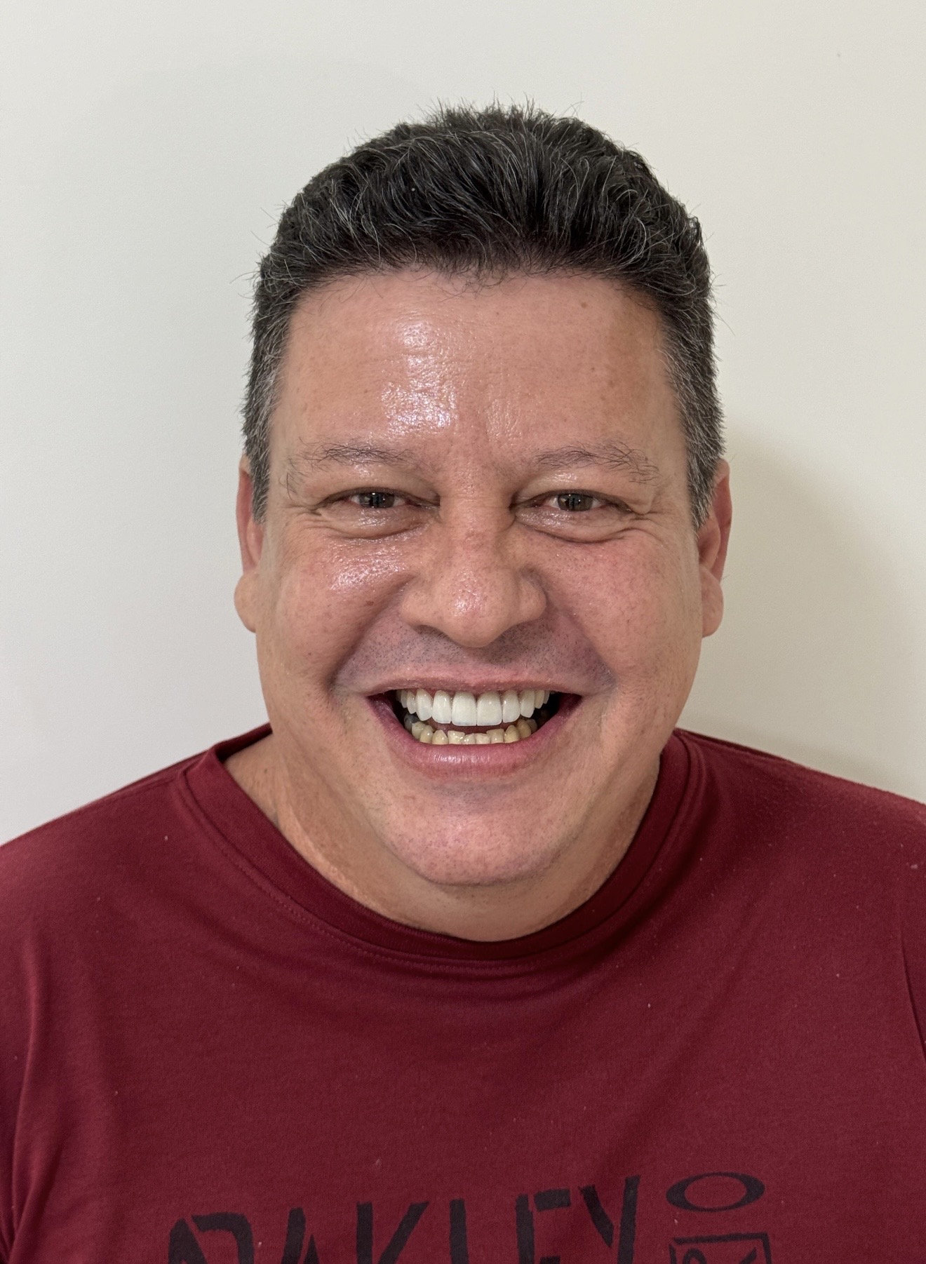 Caso depois